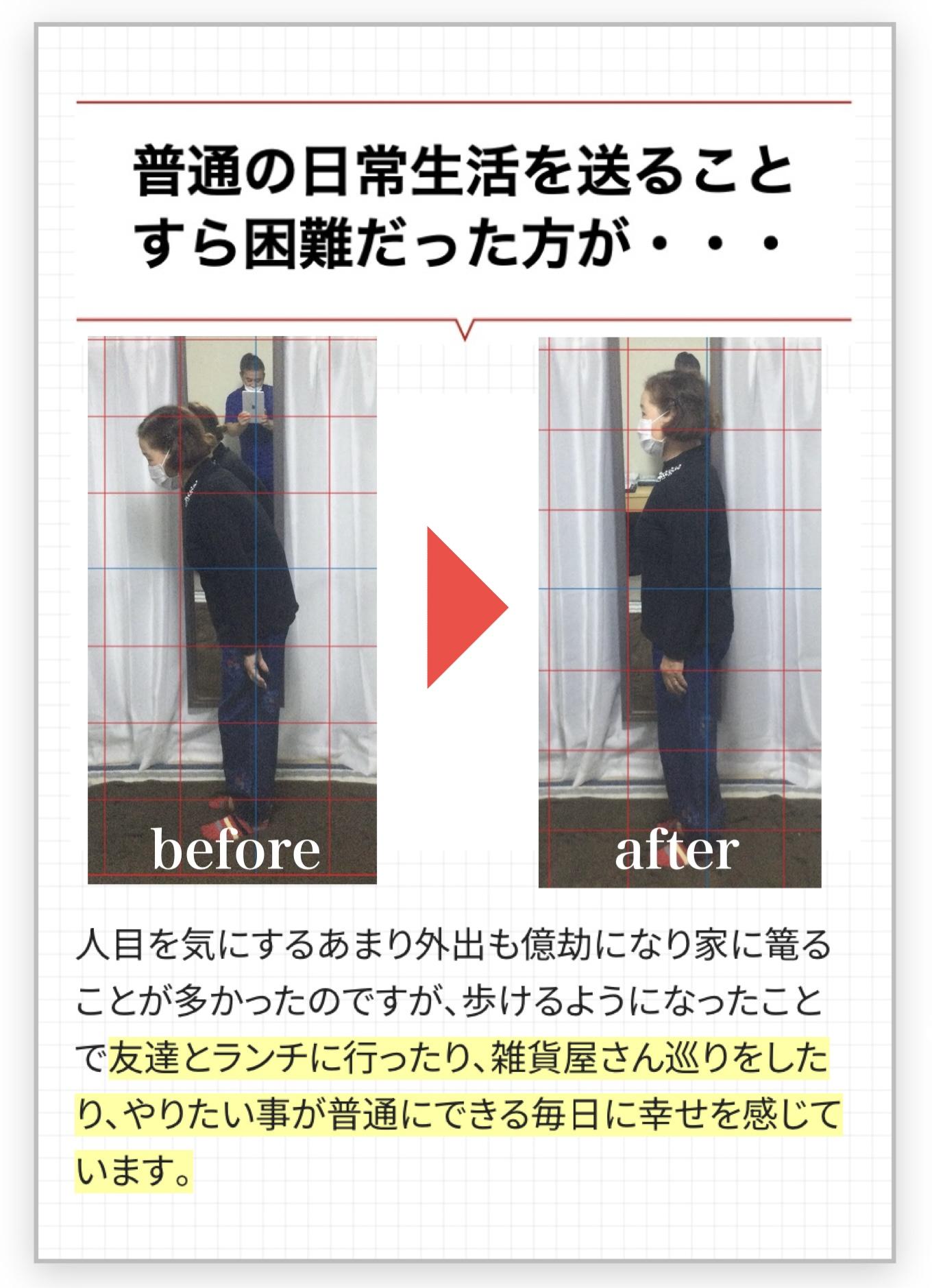 二度と一人では歩けないと思っていた方が・・・  before  after  1人でベッドから降りれたり、1人でお手洗いに行け たり、外にも出れるようになりました。体が動かず 諦めていた趣味のガーデニングを再開できたこと、 息子夫婦の介助を受ける頻度も格段に減ったこと で心も穏やかになってきています。