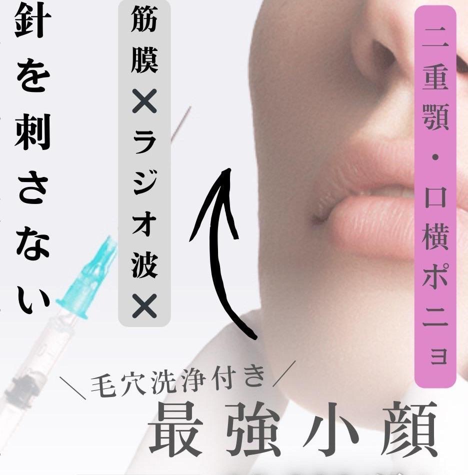 阪神西宮　アンリミット　こだわり１