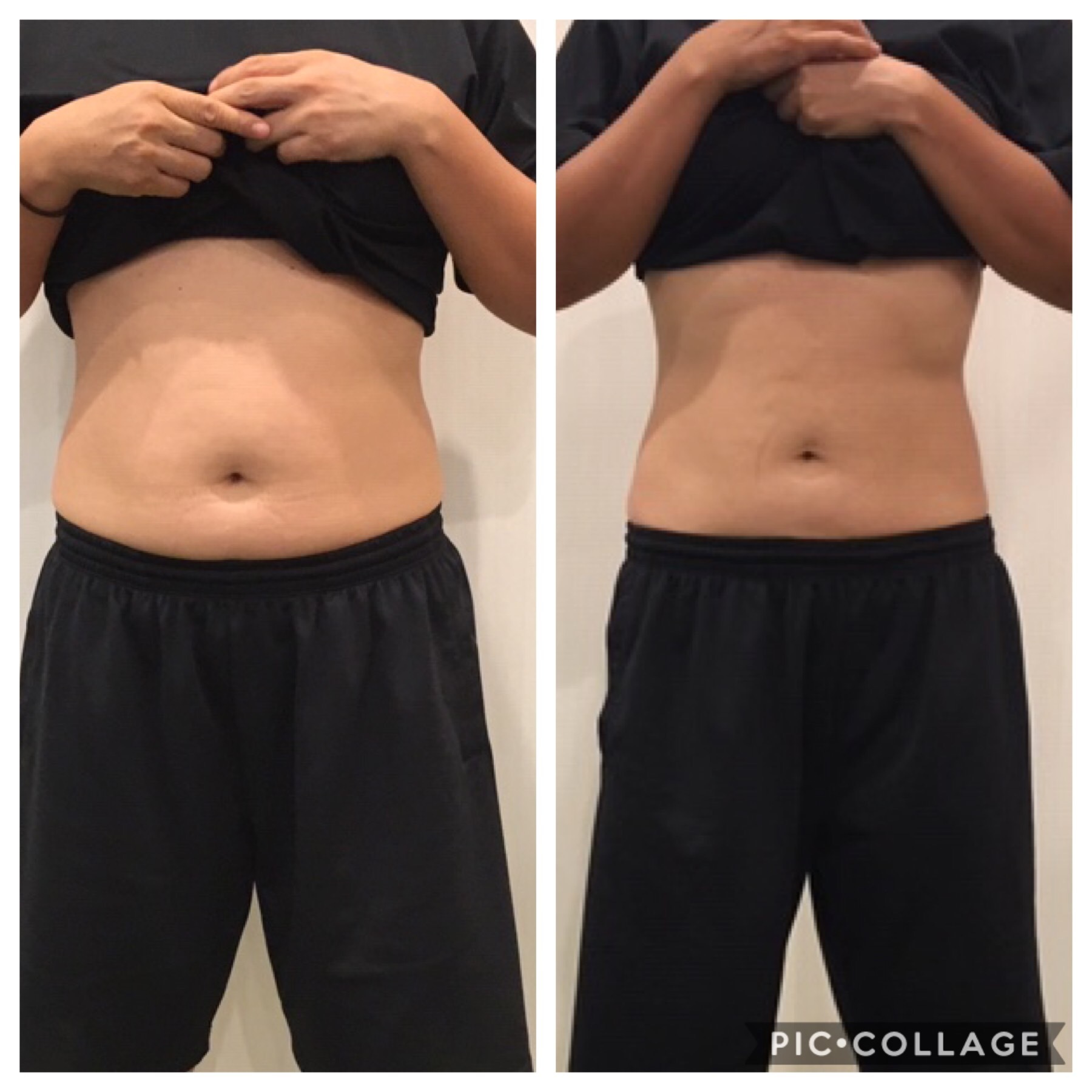 Asfitのパーソナルトレーニングでダイエット 台東区 葛飾区で整骨院が運営するダイエットジム