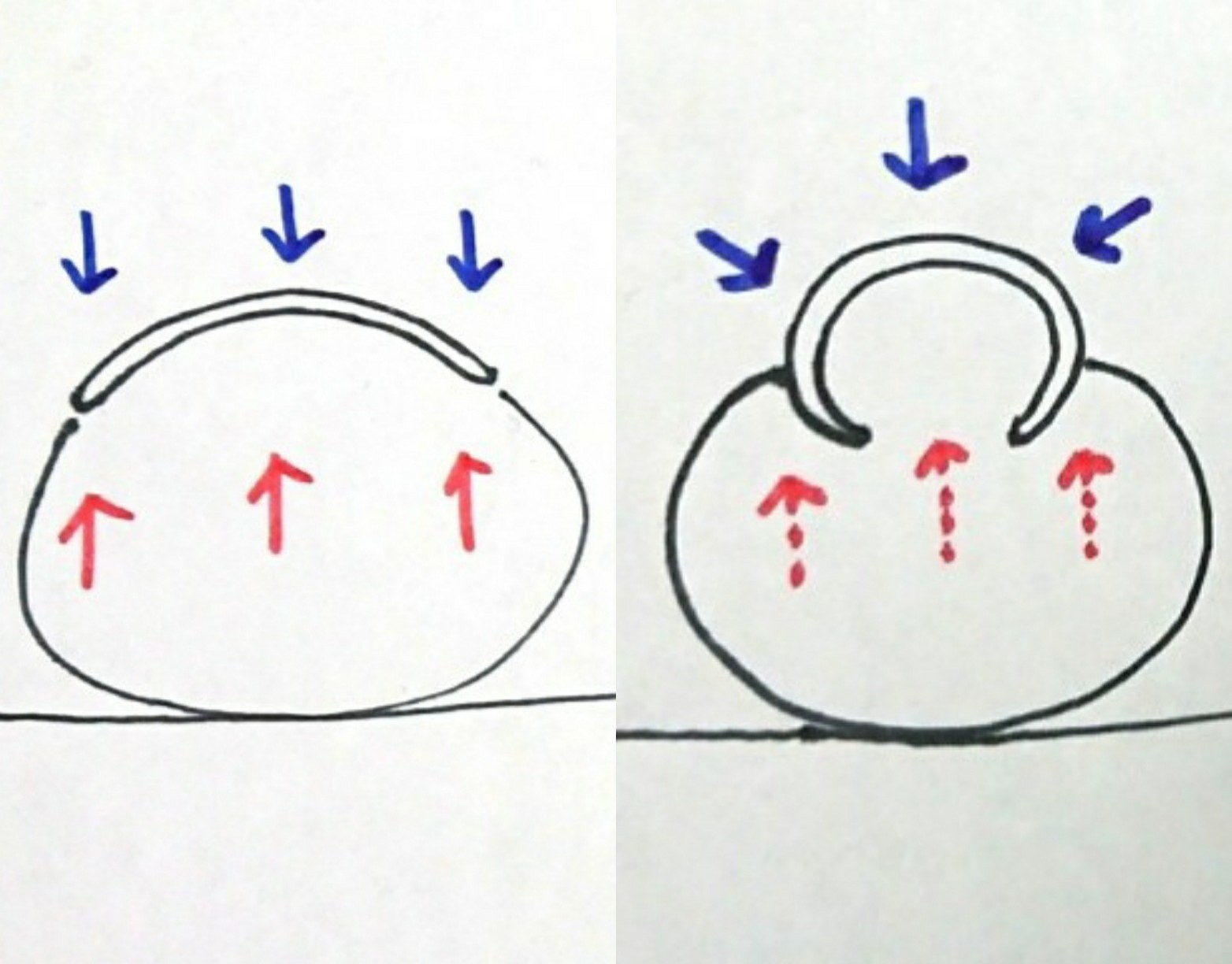 巻き爪についての解説ページ