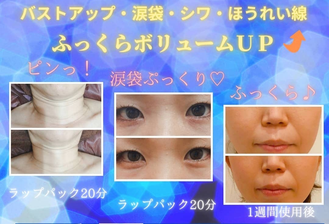 フェイシャルエステsiele シエル 小顔矯正 フェイシャル シェービング