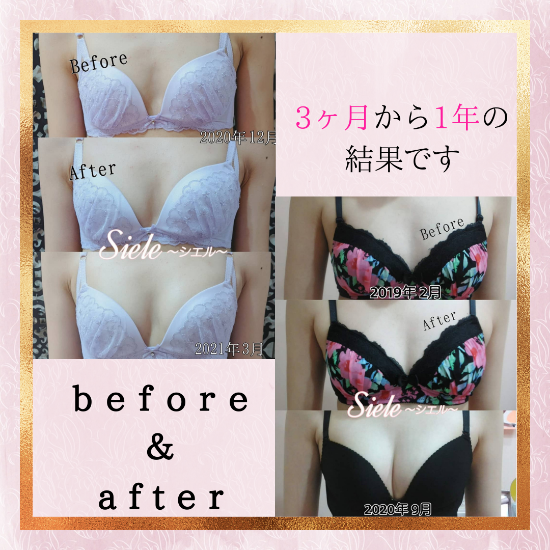 広島の育乳バストアップサロンsiele シエル 光豊胸エステでバストケアするシエルアップ育乳法