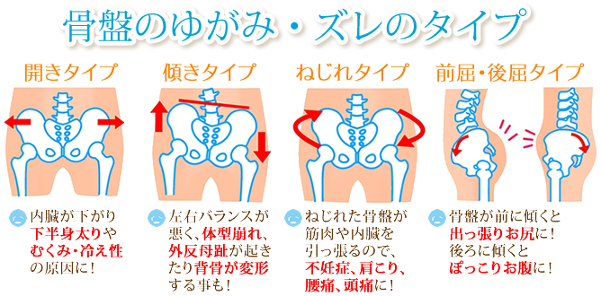 広島の痩身エステはシエル Siele バストは痩せないダイエット