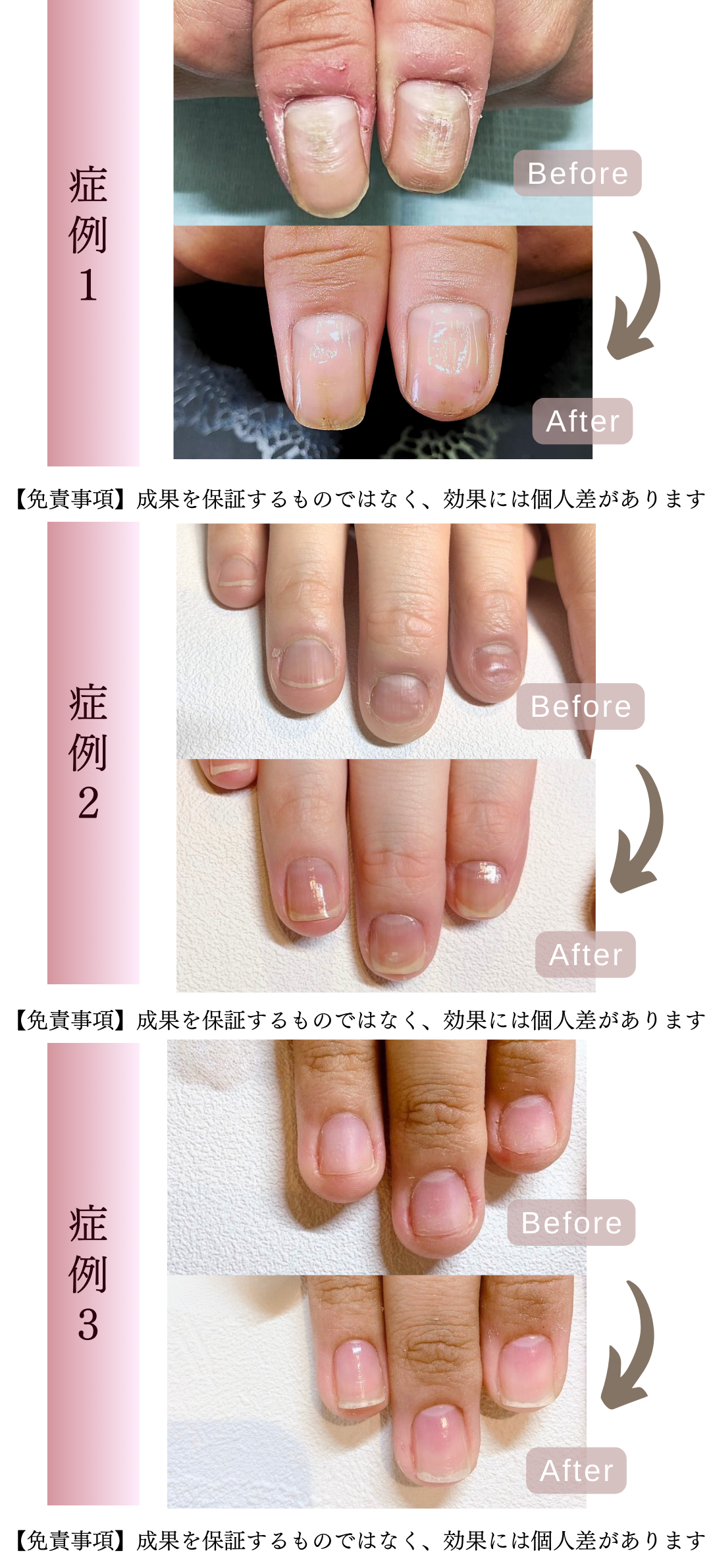 施術例の写真