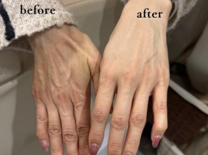 美爪キープ4か月プログラムサンプル写真