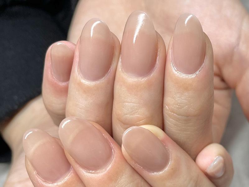 リプロネイル式深爪矯正専門サロンブルームーンネイルズの結果写真