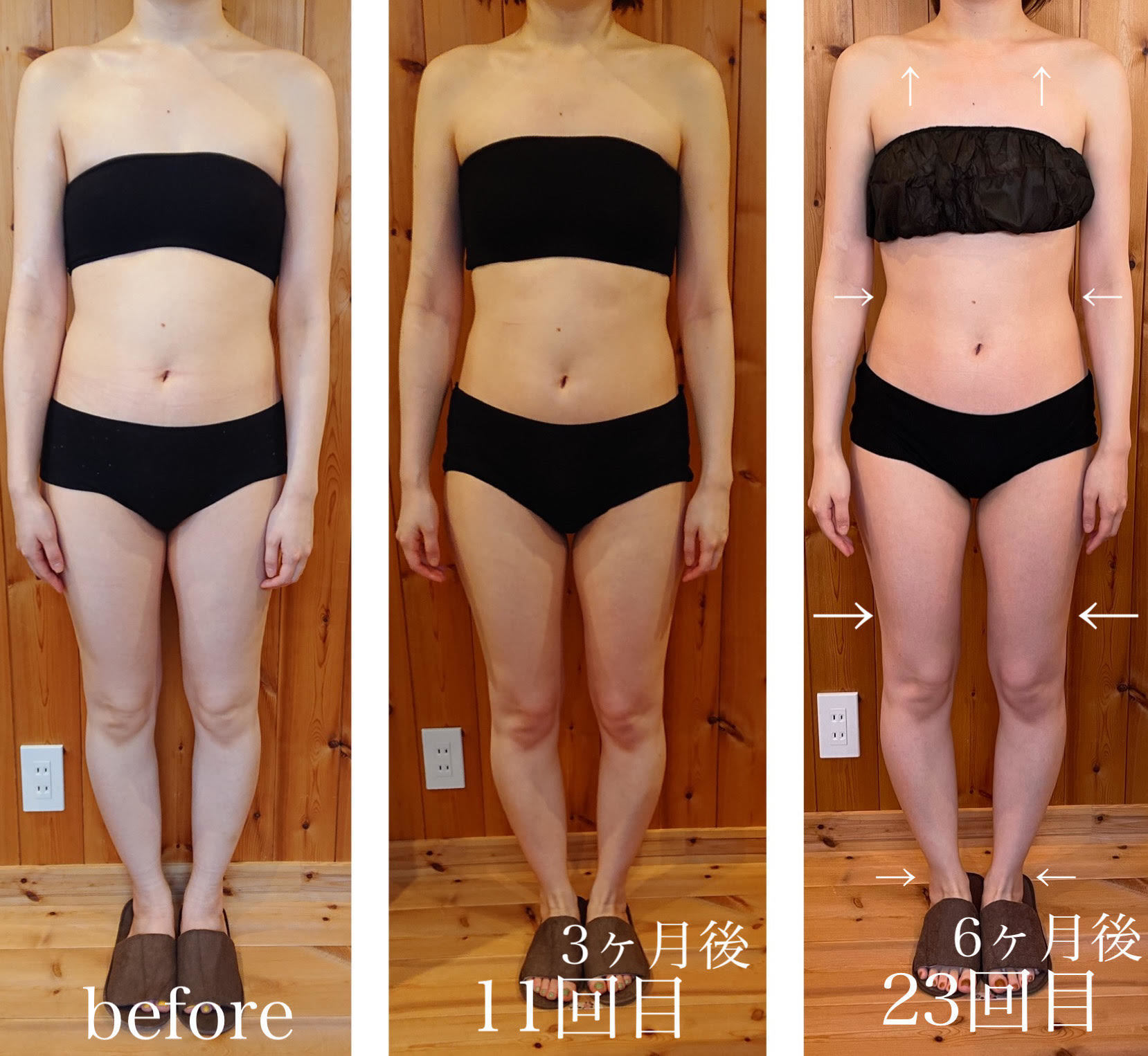 コアヒート美ボディ90分30代のお客様の結果写真