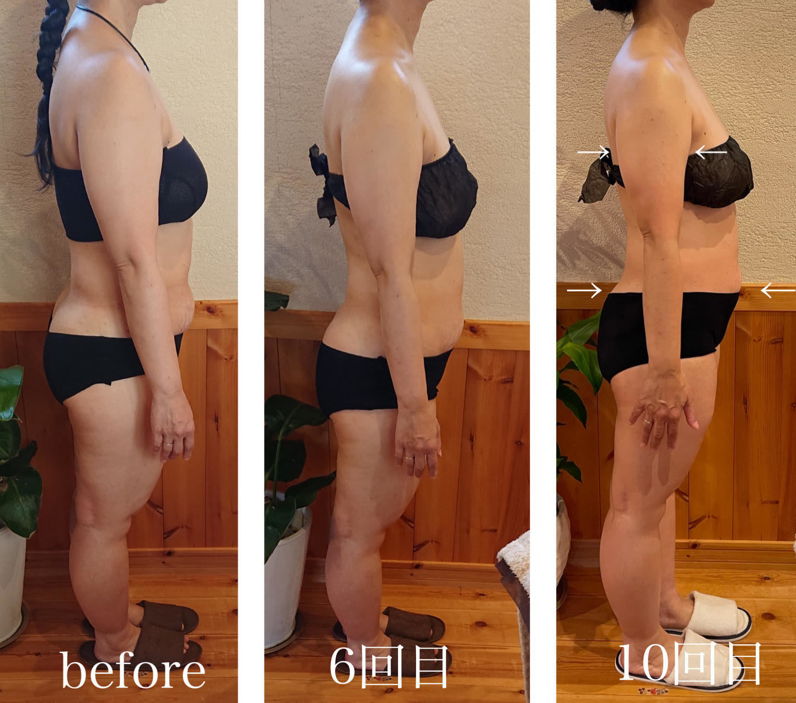 コアヒート美ボディ90分40代のお客様の結果写真