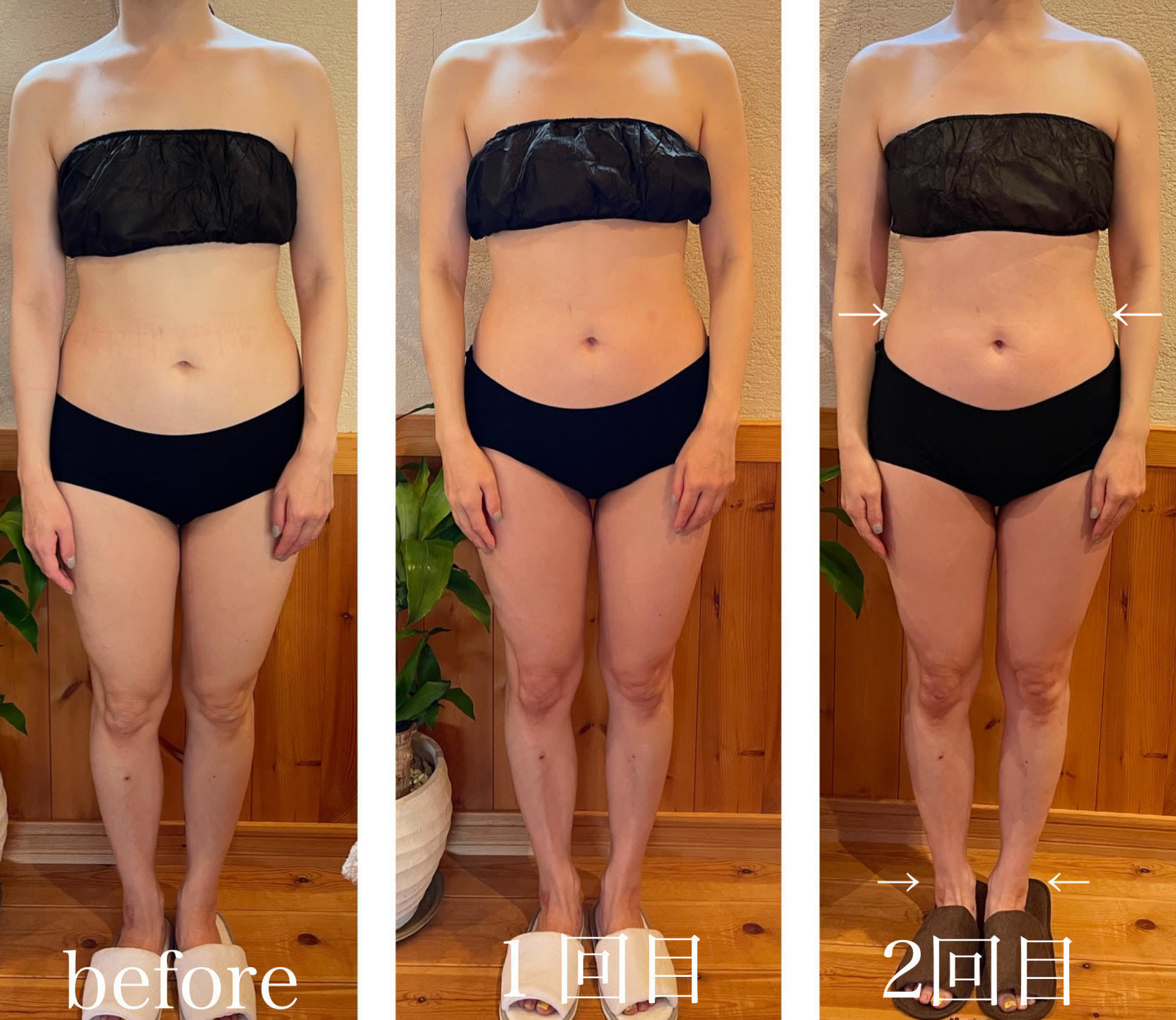 コアヒート美ボディ90分40代のお客様の結果写真