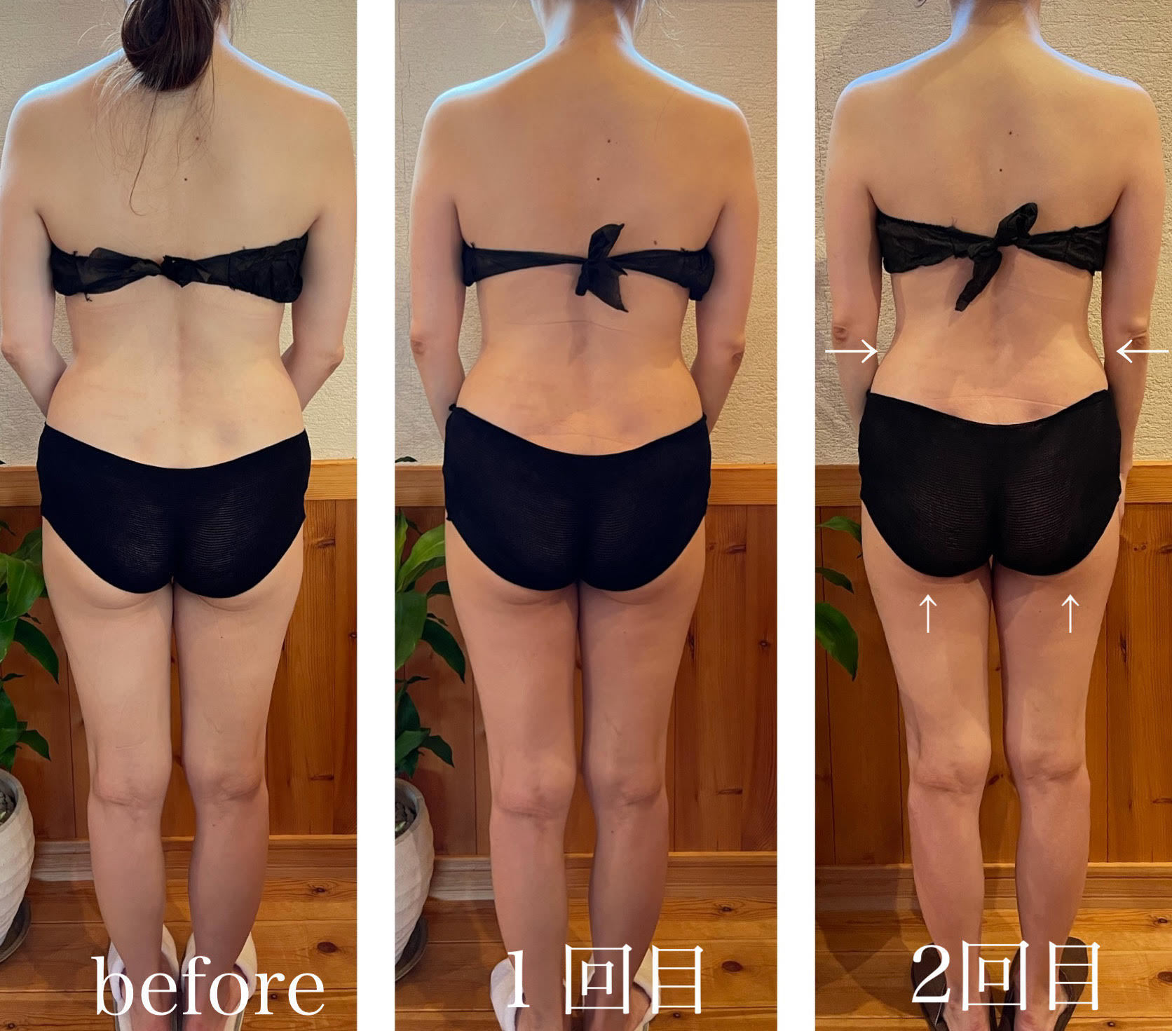 コアヒート美ボディ90分40代のお客様の結果写真