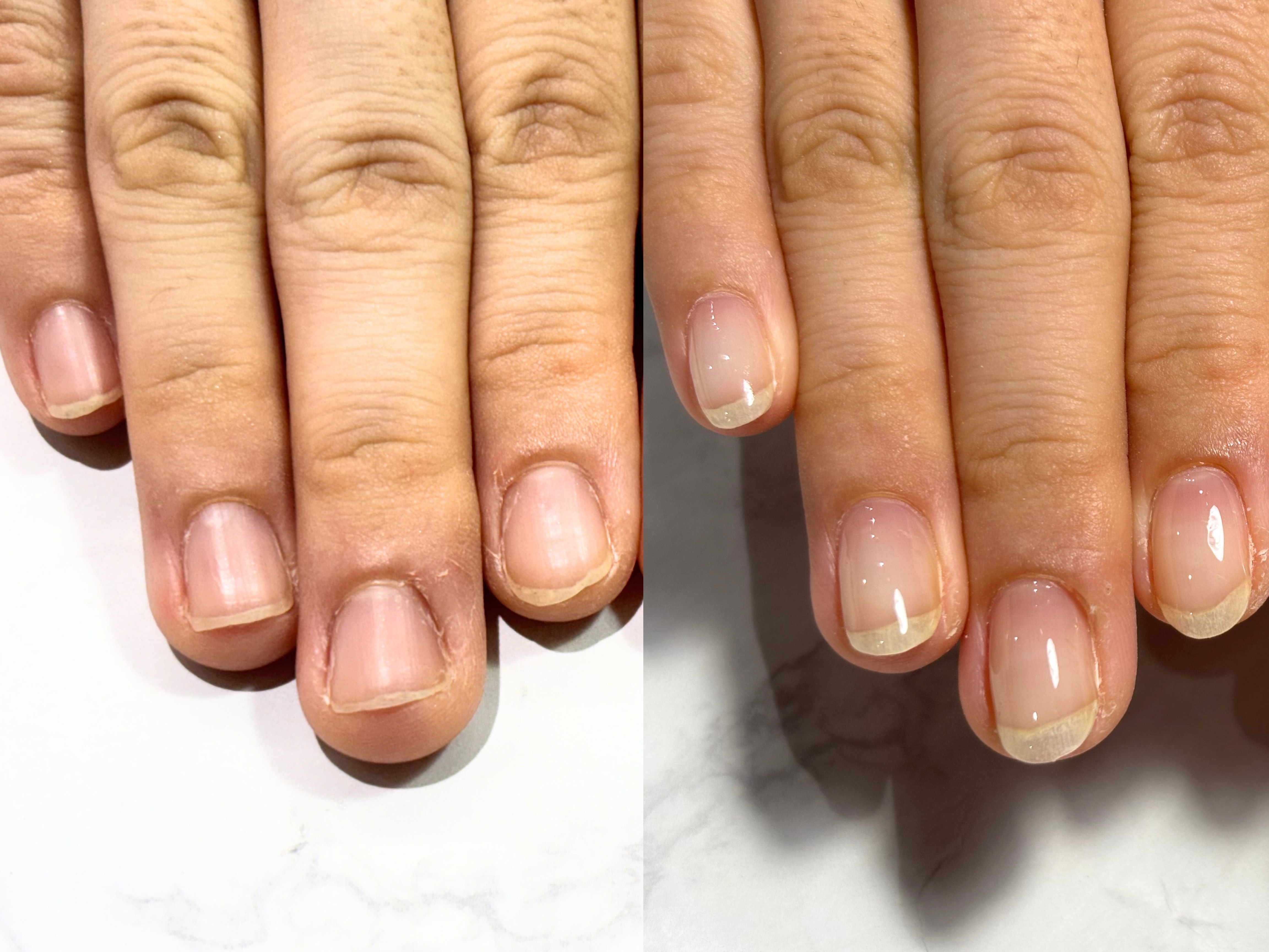 美爪強化4ヶ月プログラムサンプル写真