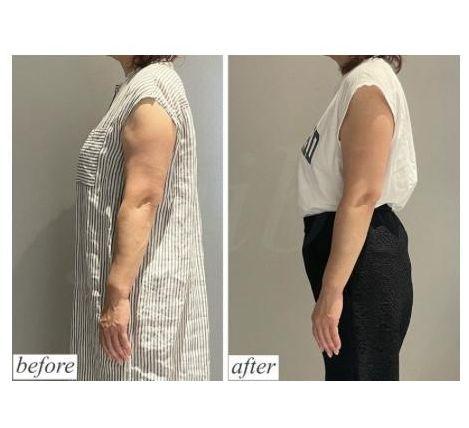 兵庫県西宮市 フェイシャル＆痩身エステサロン フェーブル コアヒート結果写真