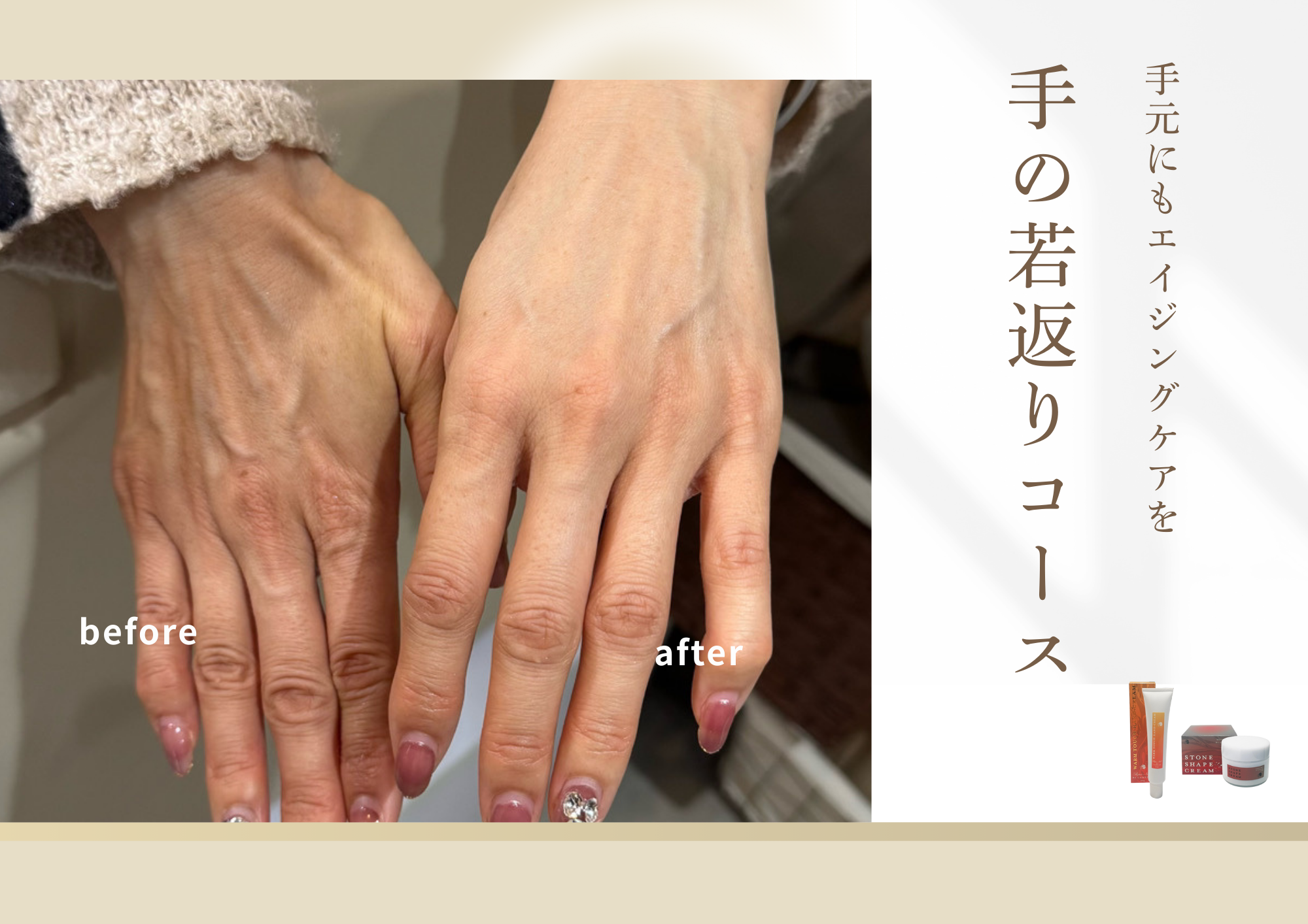 手の若返りコースひじした〜手首（全4回＋ホームケア2点付き）