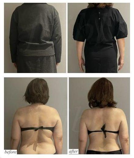 兵庫県西宮市 フェイシャル＆痩身エステサロン フェーブル コアヒート結果写真