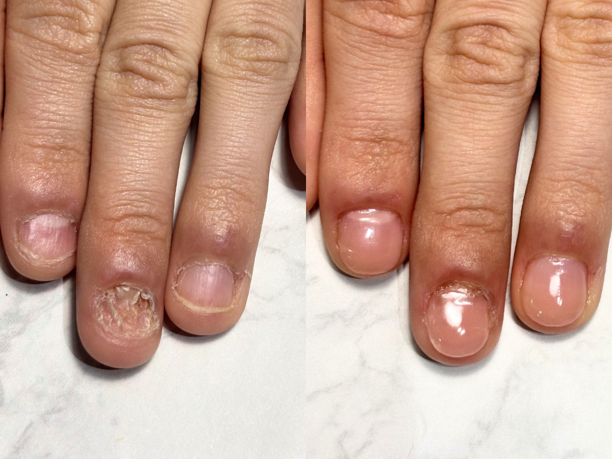 神戸市深爪矯正・爪質改善専門ネイルサロン アリエ