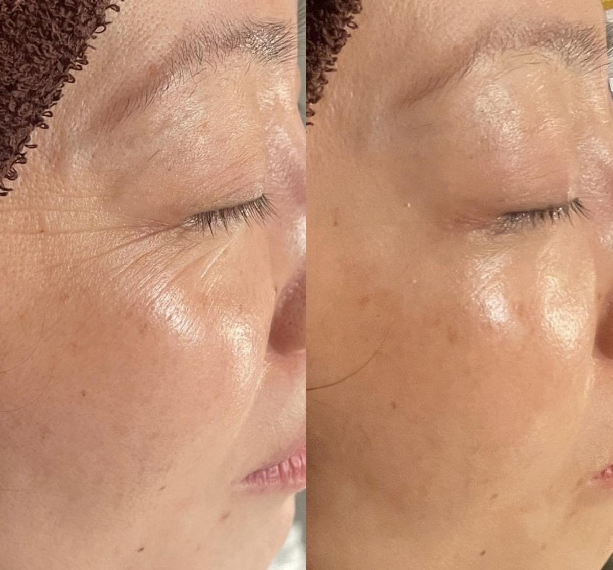 堺市堺区エステサロンVIAGE(ヴィアージュ)プロセルセラピーズ結果写真