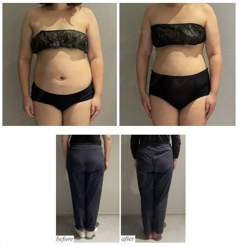 兵庫県西宮市 フェイシャル＆痩身エステサロン フェーブル コアヒート結果写真