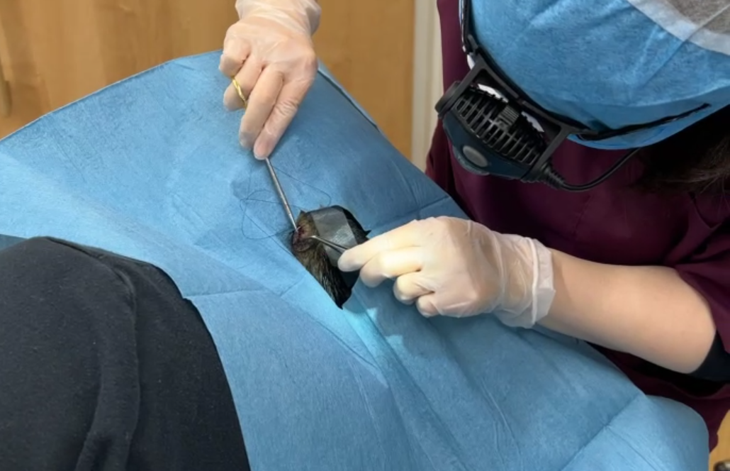 suture