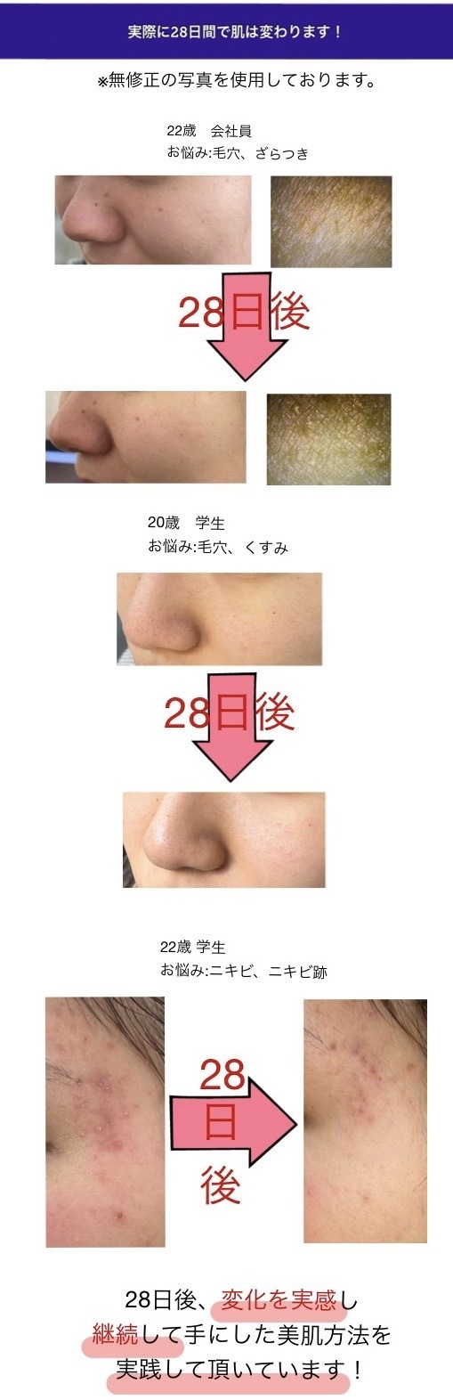汚肌から28日間で本物のすっぴん美肌に