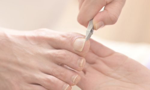 足ケア・かかとケア・フットケア・ネイル整形専門サロン天王寺駅3分！巻き爪矯正・角質ケア・美しい爪美しい足VISOK美足