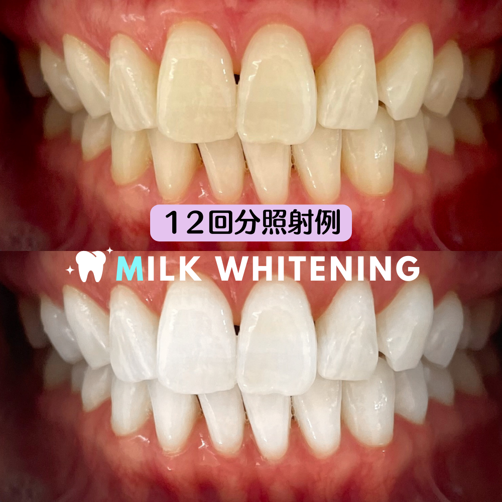 セルフホワイトニング専門 Milkホワイトニング久留米店【ミルクホワイトニング】