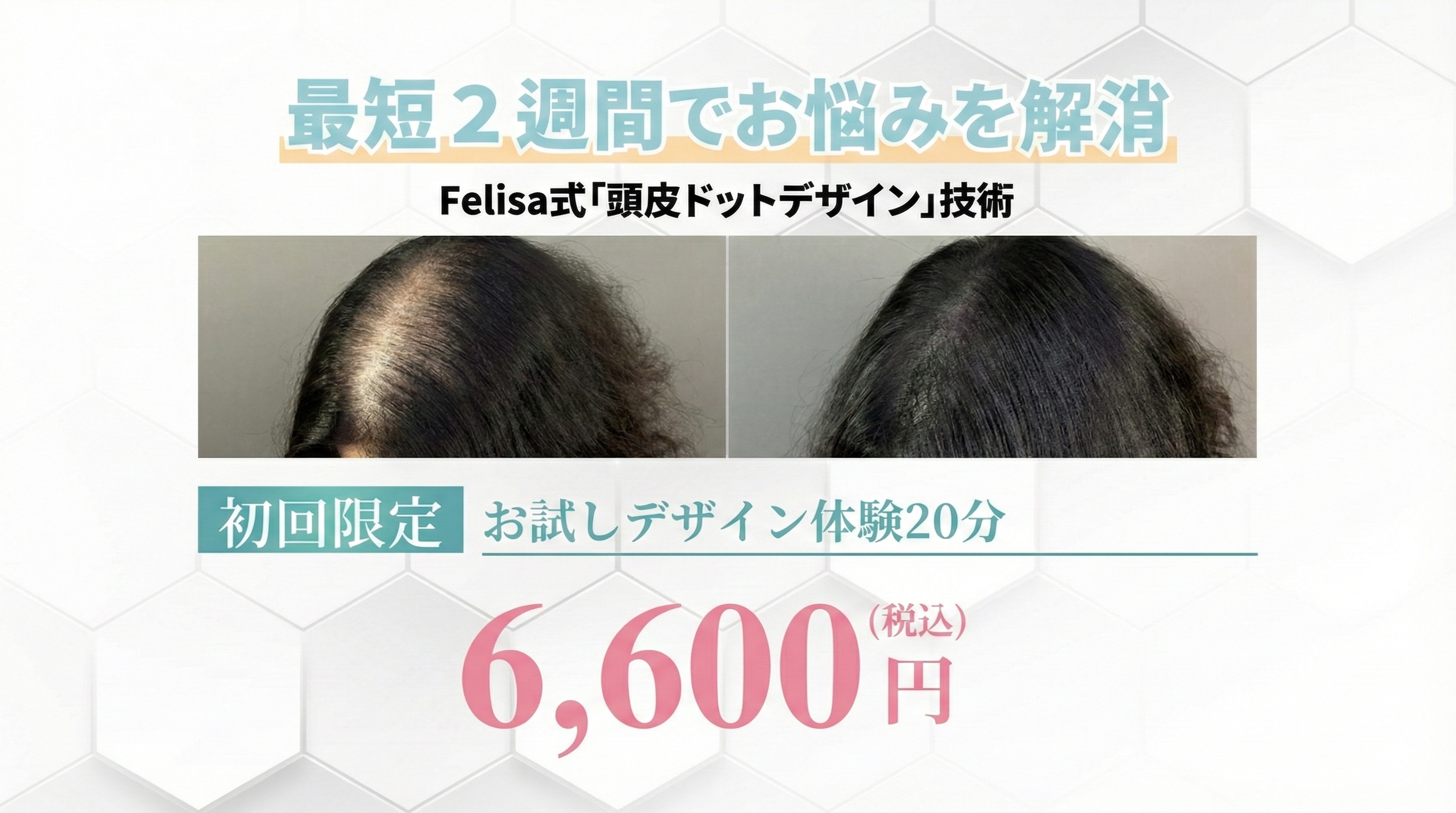 最短２週間でお悩み解消「ヘアタトゥー」お試し体験6,600円税込