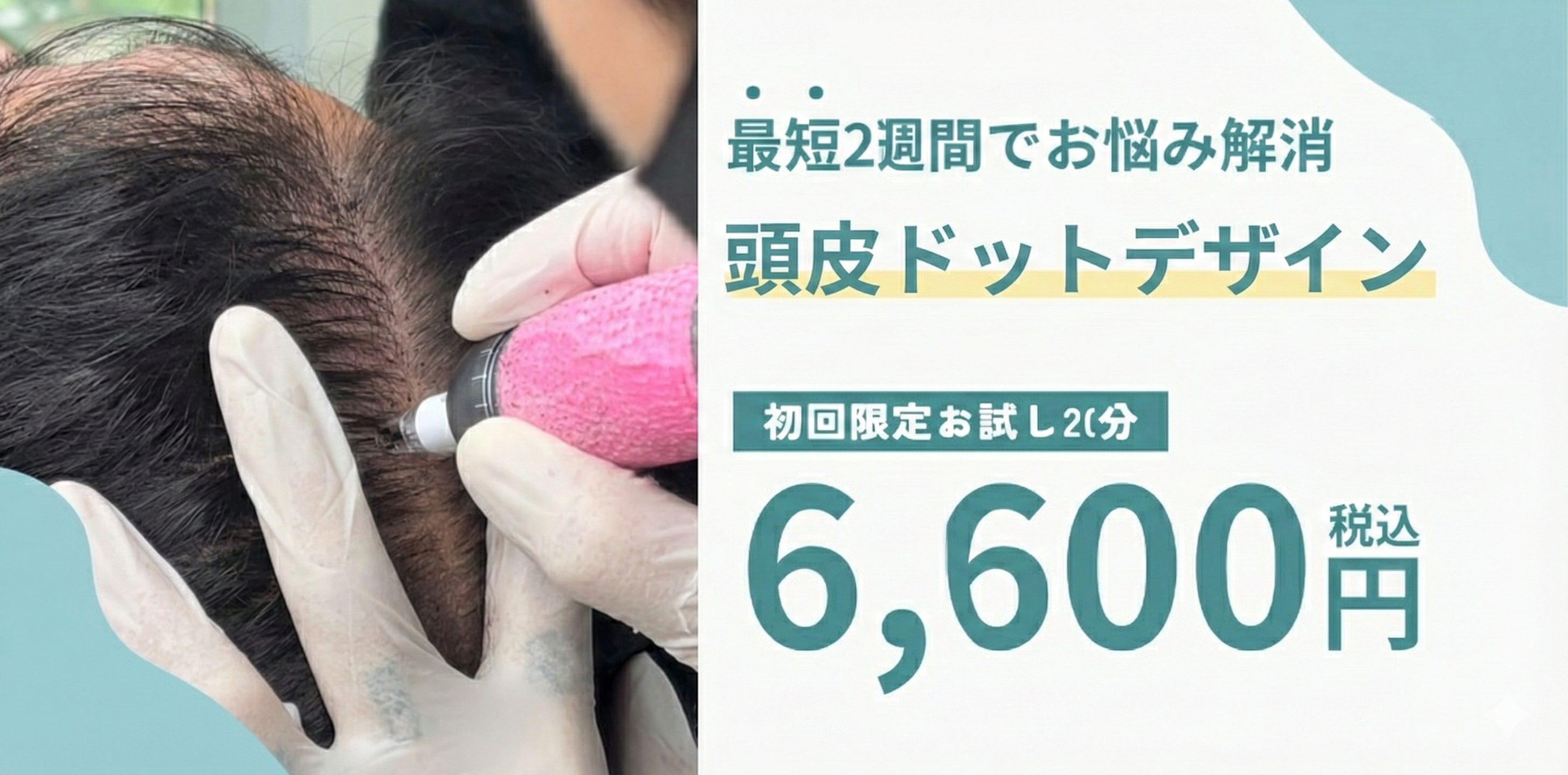 九州初のサービス”頭皮ドットデザイン”