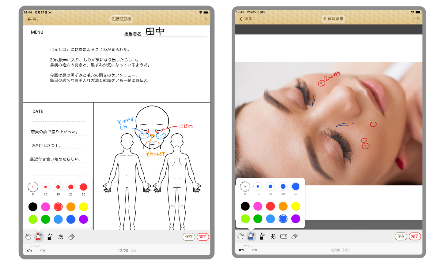 紙カルテのレイアウトのまま使えて、写真にも紙カルテにも手書きができる