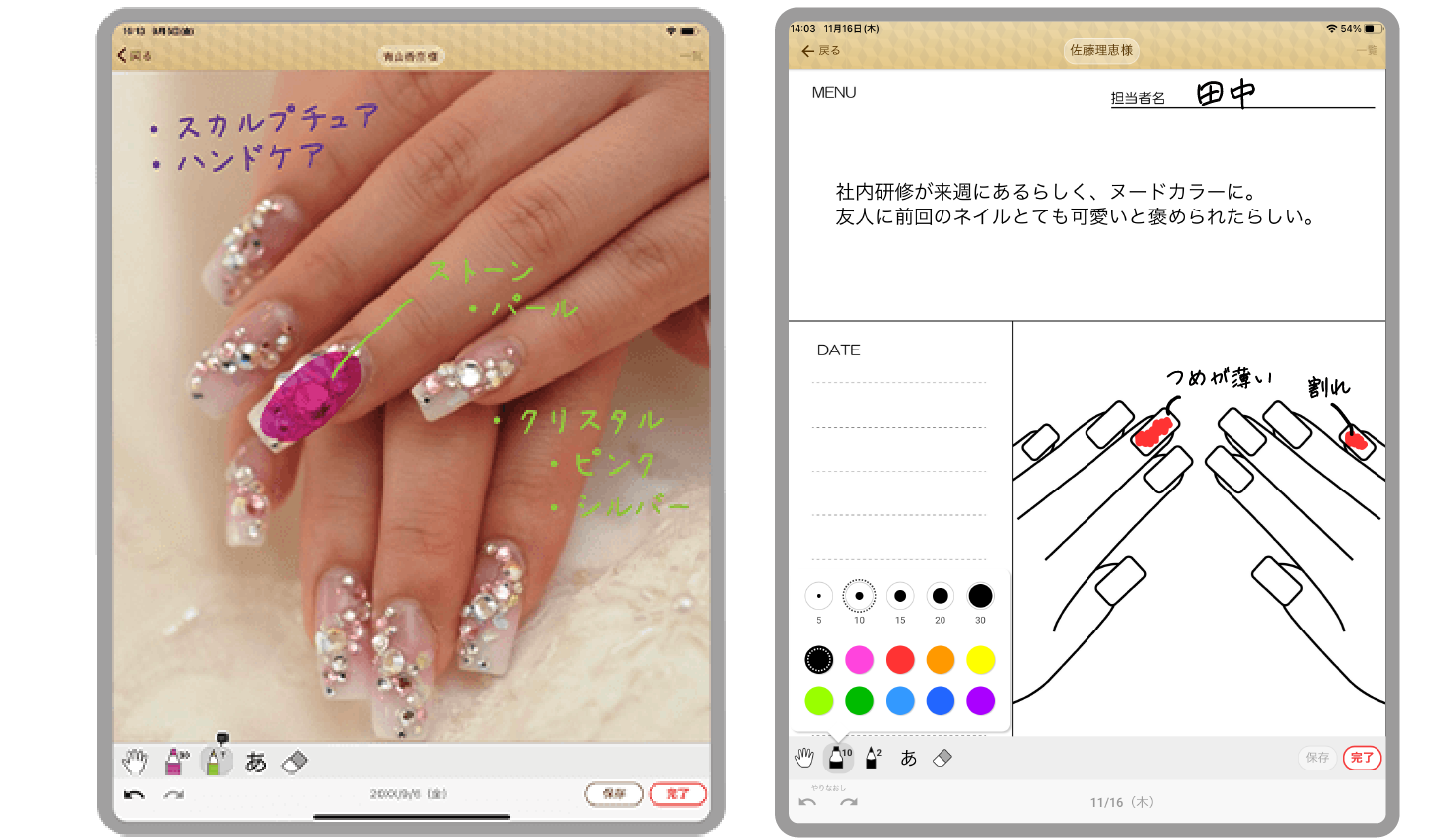 紙カルテのレイアウトのまま使えて、写真にも紙カルテにも手書きができる