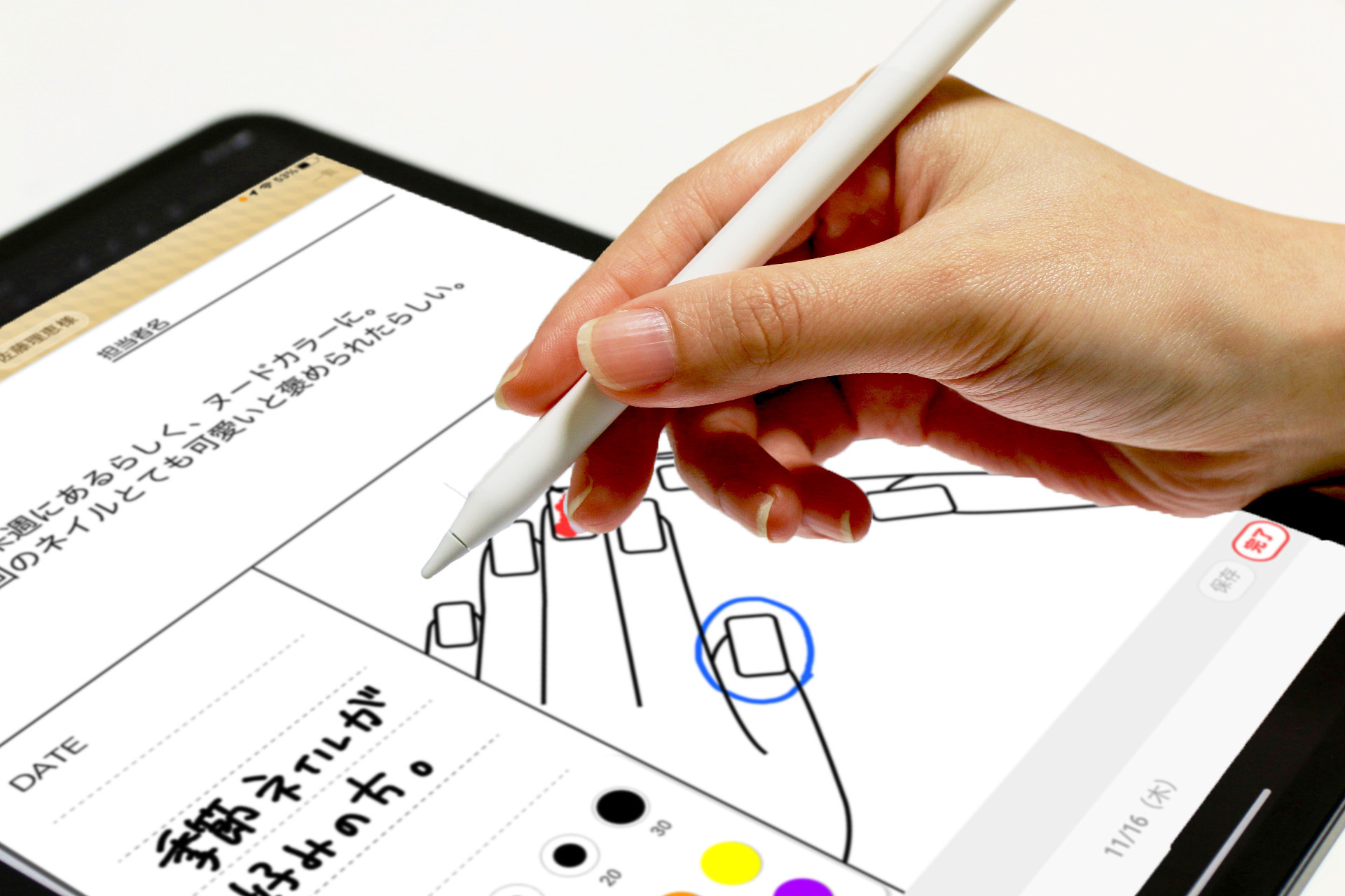 電子カルテに手書きでスラスラ記入