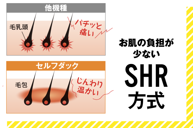 お肌の負担が少ないSHR方式