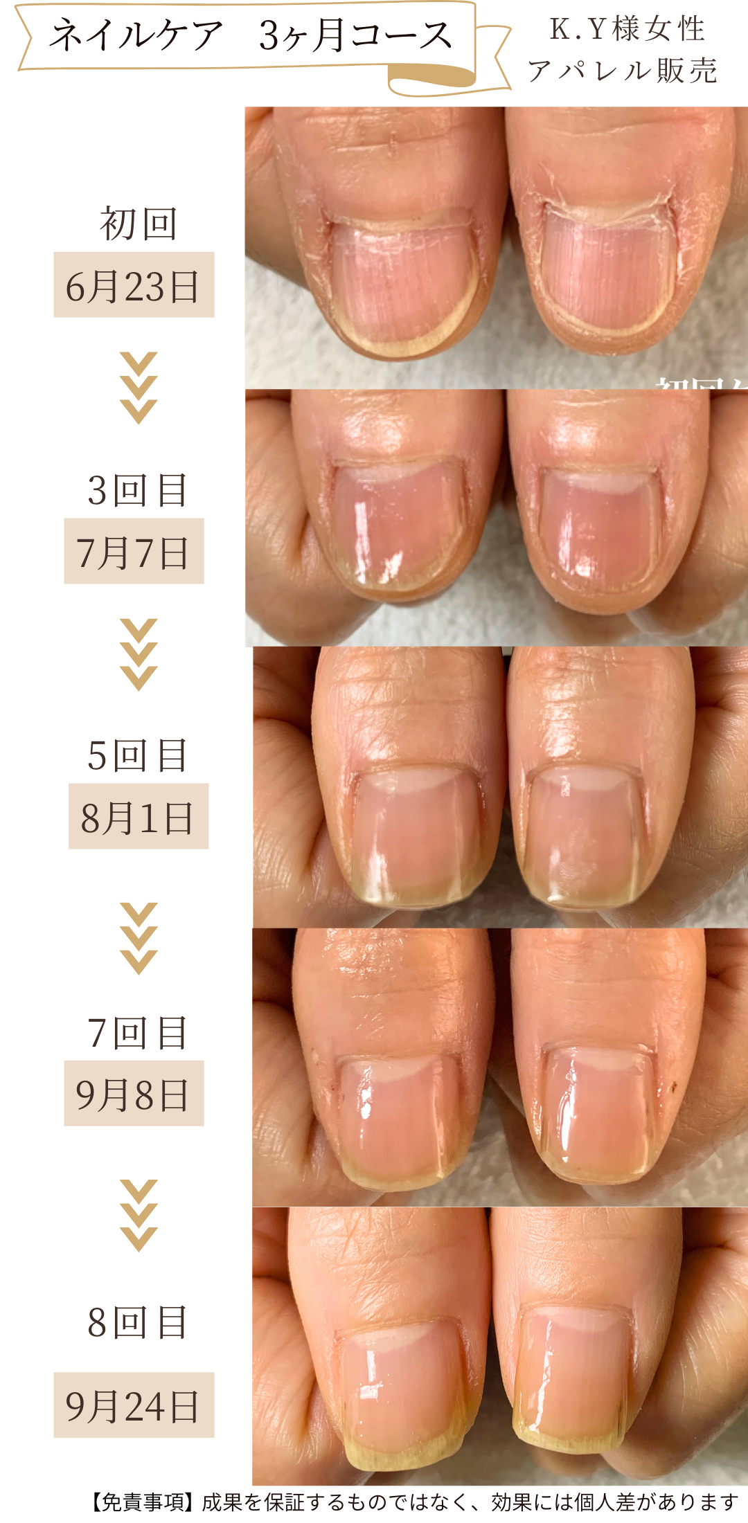 自爪育成３ヶ月の育成経過症例写真　浜松市 | 自爪育成ネイルケアサロン Nail salon Nagi