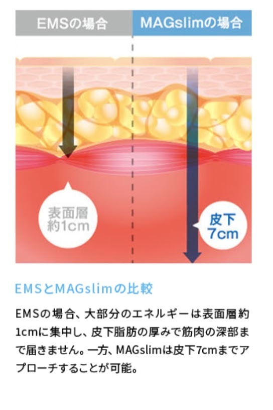 マグスリムの効果