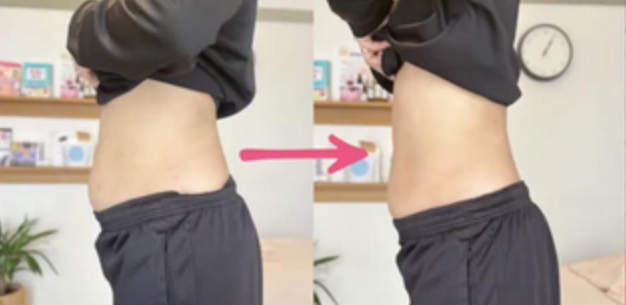たった1回の施術でお腹周り-4㎝のビフォアフ画像