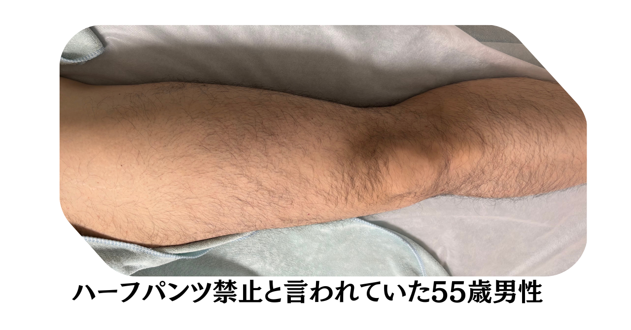下半身脱毛の効果と家族の変化を紹介するイメージ画像