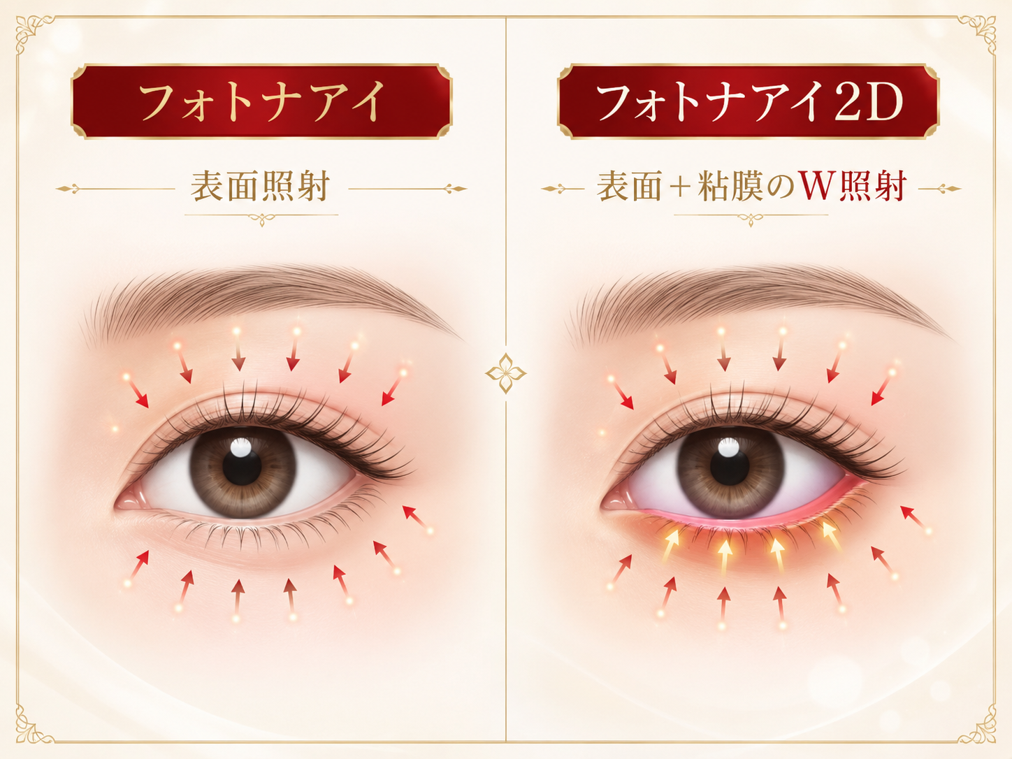 フォトナアイとフォトナアイ2Dの照射方法の違い