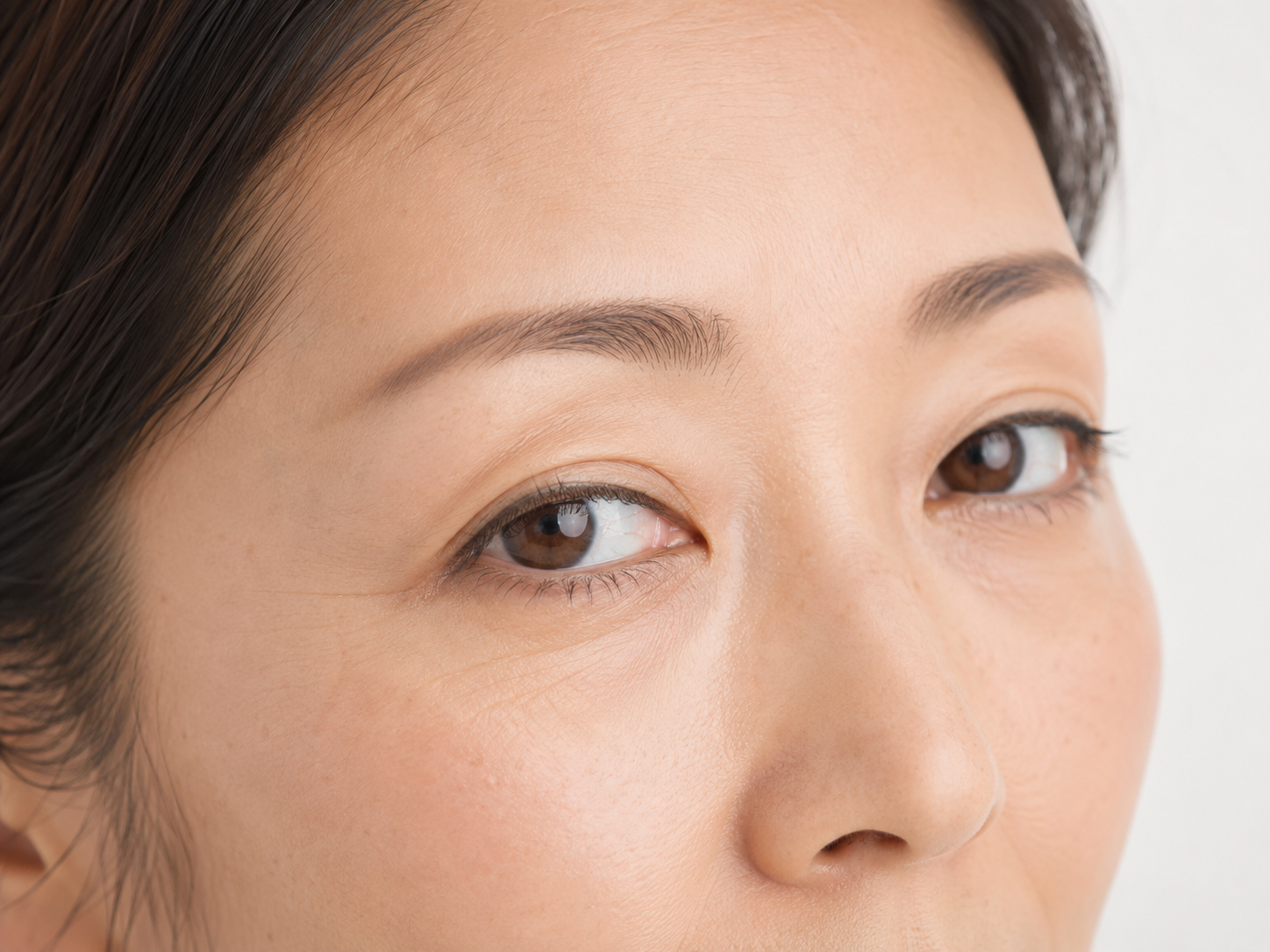目元の小じわやたるみが気になる女性