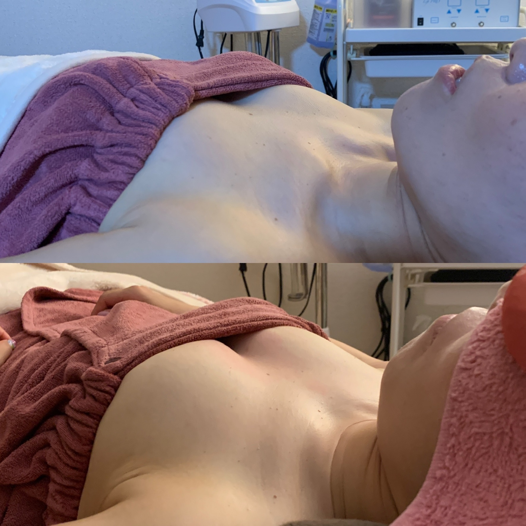 Before/After
