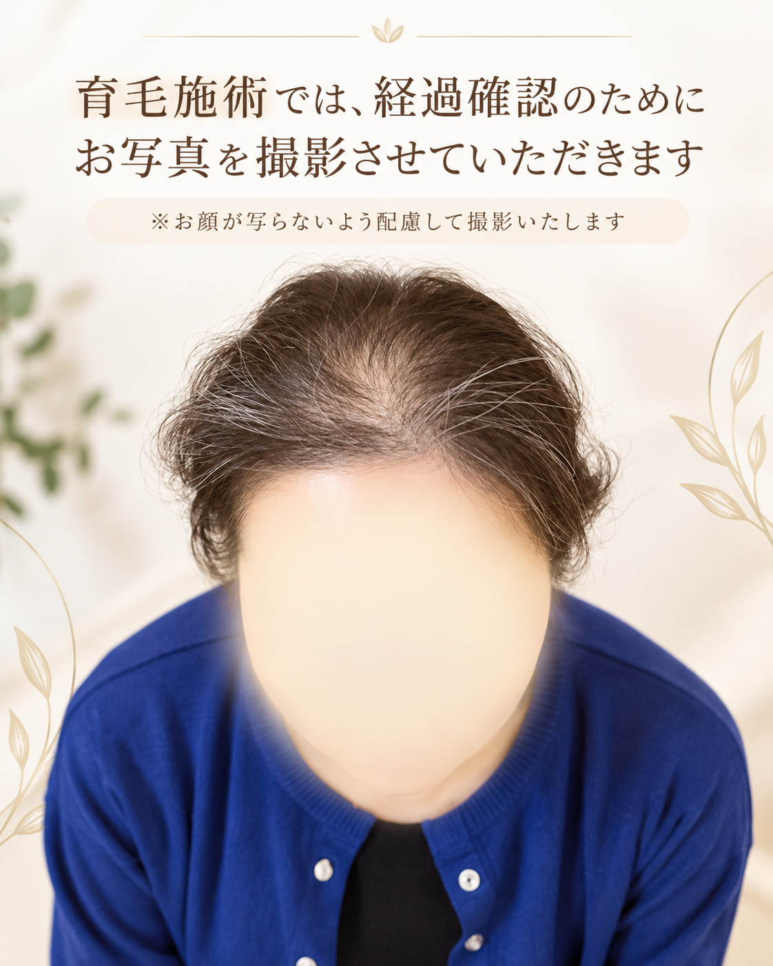 育毛治療でお写真を撮らせていただきます
