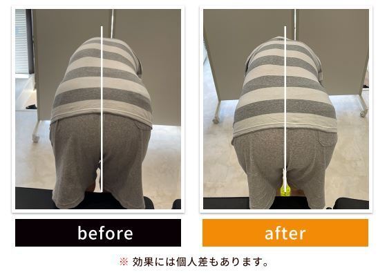 滋賀大津　整骨・はりボディワークス　脊柱管狭窄症・頚椎症・すべり症・椎間板ヘルニア・坐骨神経痛などの重症の方の専門院　ゆがみ矯正