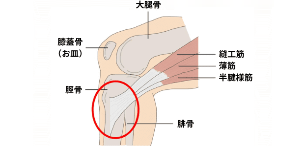 鵞足炎の図解