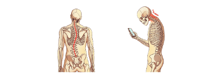 背骨のゆがみ、骨盤のゆがみによって痛みや不調が起こる