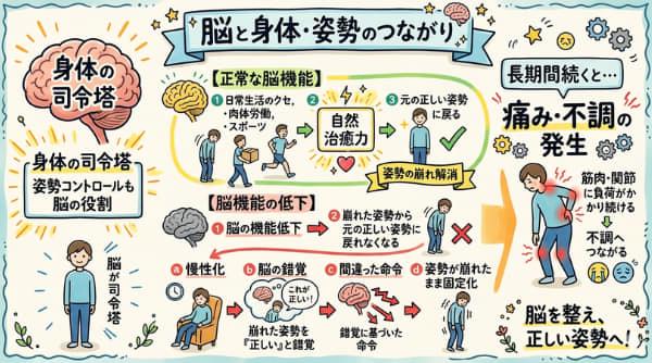 脳の機能低下が姿勢の崩れを起こすことを説明しているグラフィックレコーディング