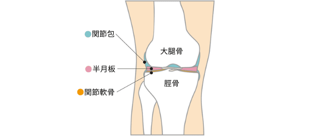 半月板損傷の図解