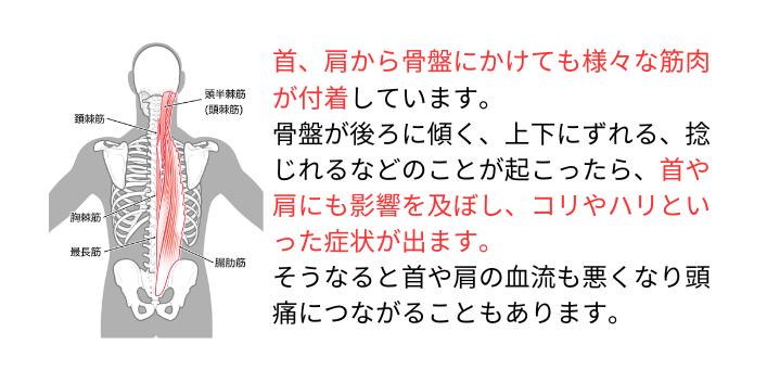 身体のゆがみが引き起こすこと