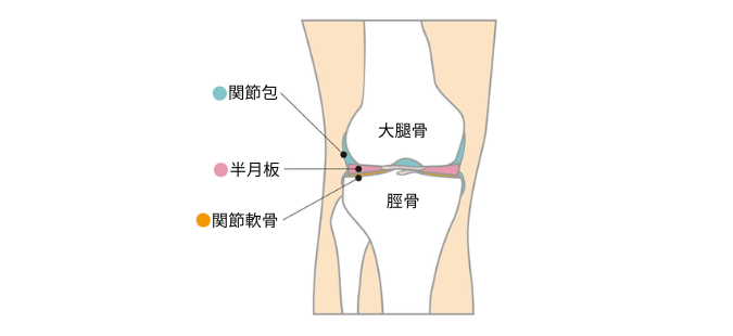 半月板損傷の図解