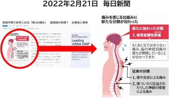 痛覚変調性疼痛に関する新聞記事