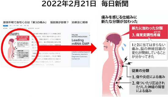 痛覚変調性疼痛に関する新聞記事