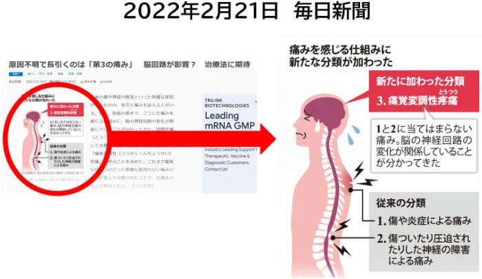痛覚変調性疼痛に関する新聞記事