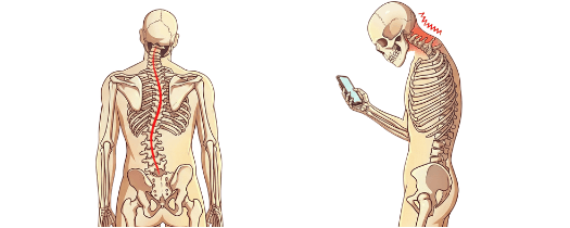 背骨のゆがみ、骨盤のゆがみによって痛みや不調が起こる